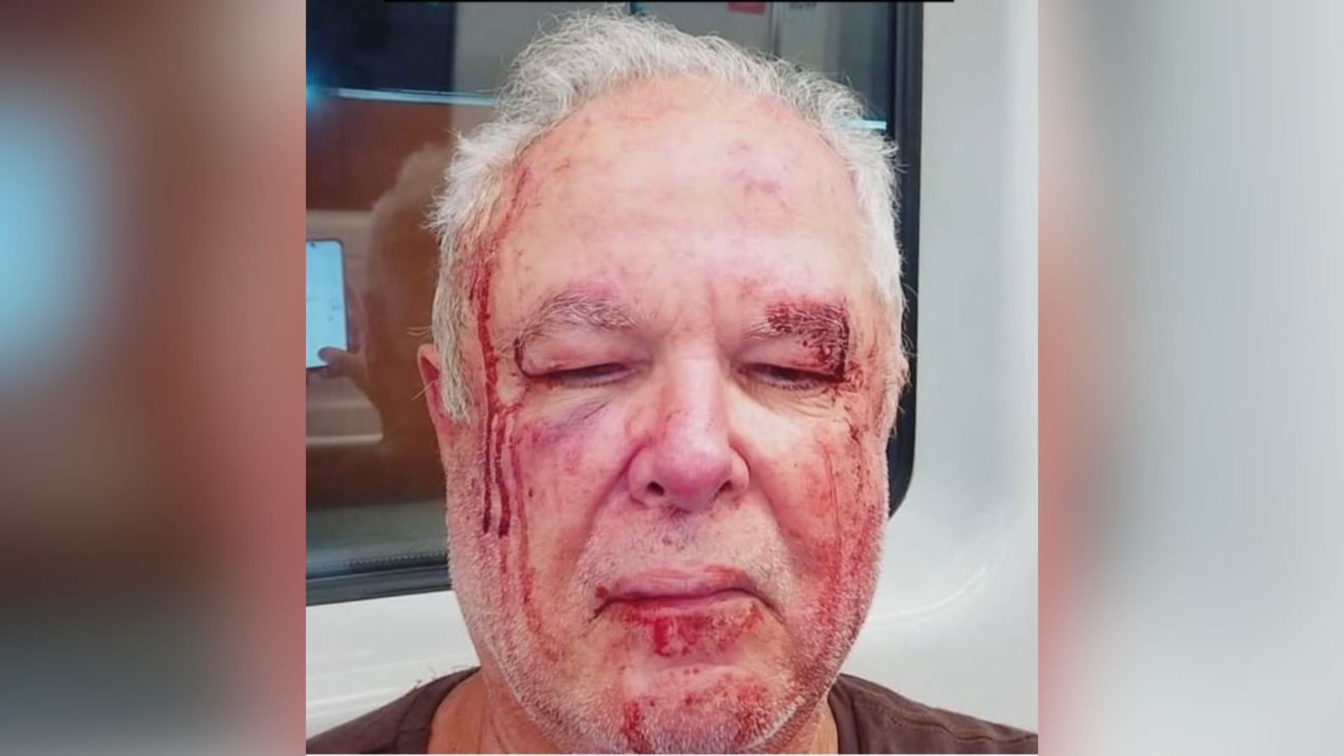 Polícia investiga agressão a idoso militante de esquerda no RJ