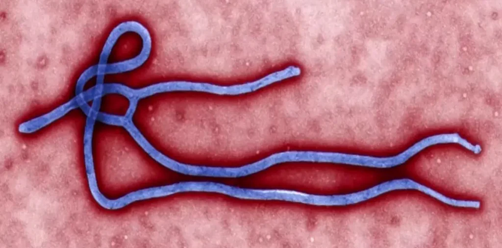 Caso suspeito de ebola é descartado no Rio Grande do Sul