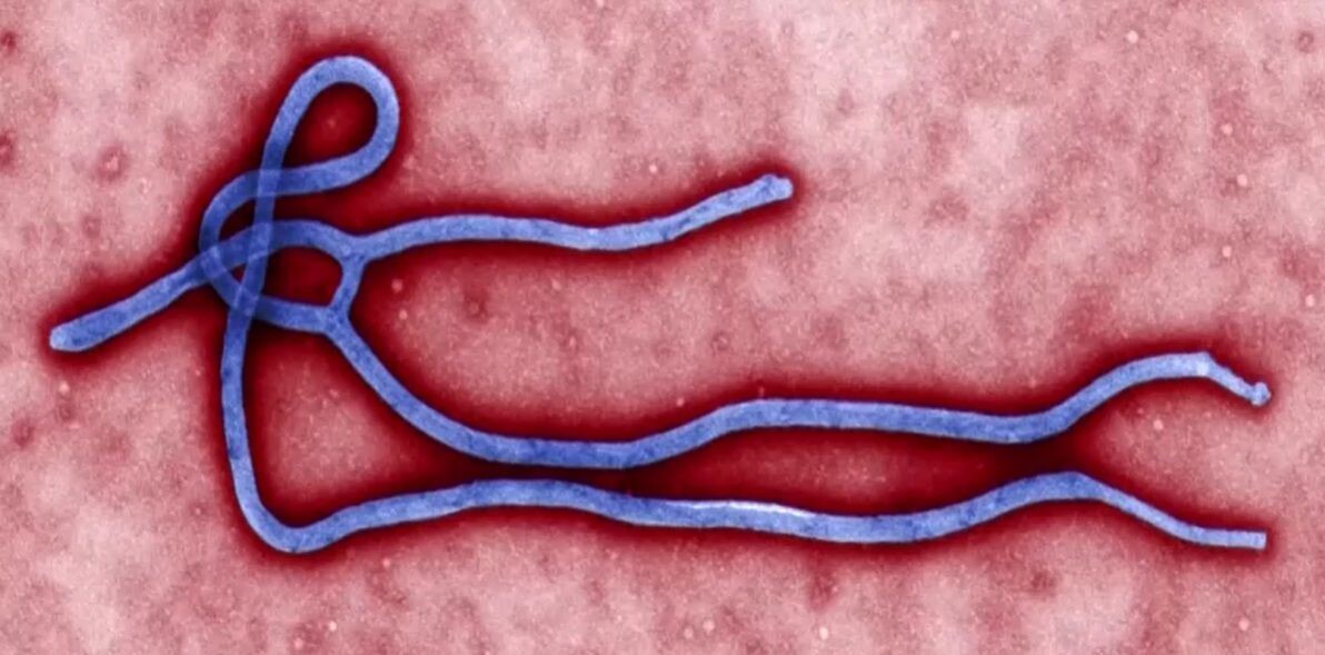 Caso suspeito de ebola é descartado no Rio Grande do Sul